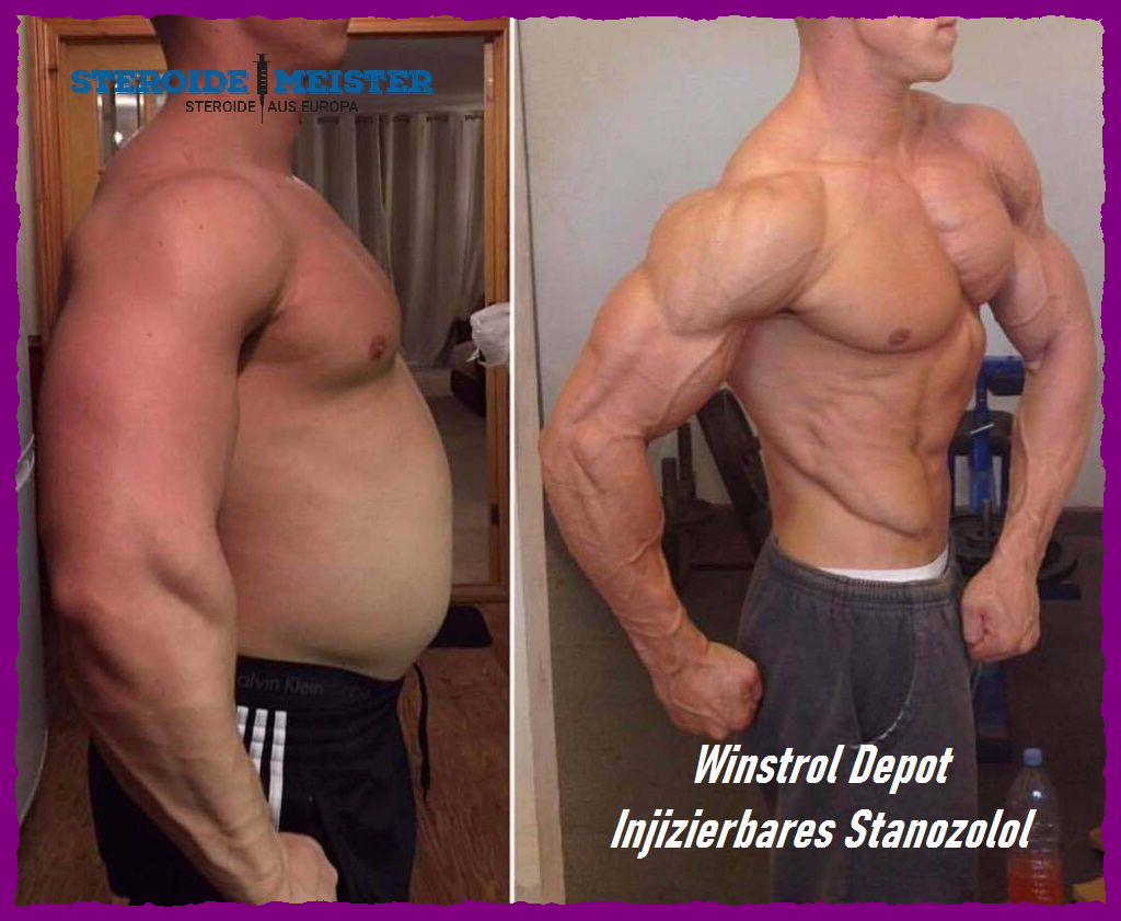Winstrol Depot (Injizierbares Stanozolol) 15 Winstrol Depot (Injizierbares Stanozolol) – Anwendung, Wirkung und potenzielle Nebenwirkungen